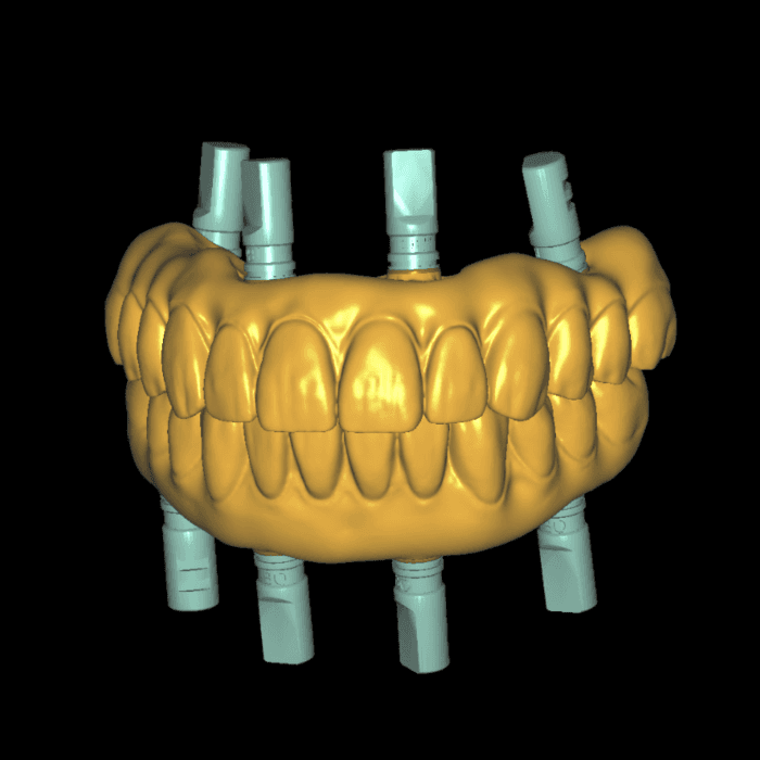 fullarchDesignService