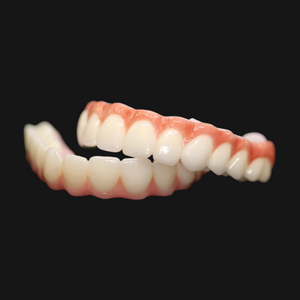 Upper and lower set of hybrid teeth implants.